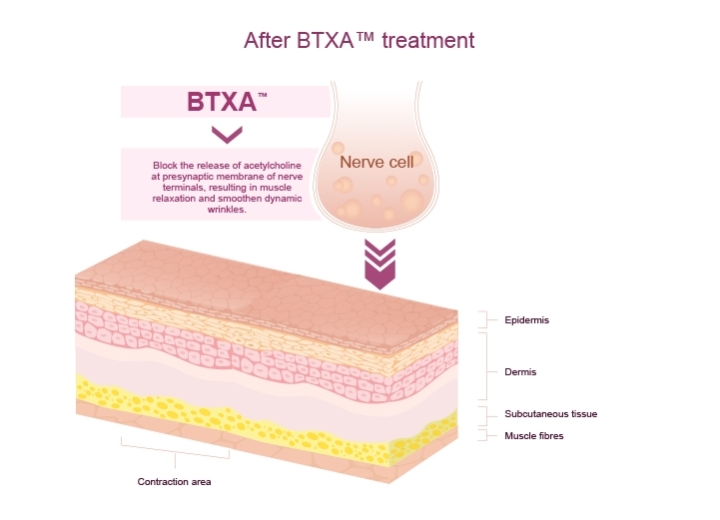 How BTXA works (0413)-02