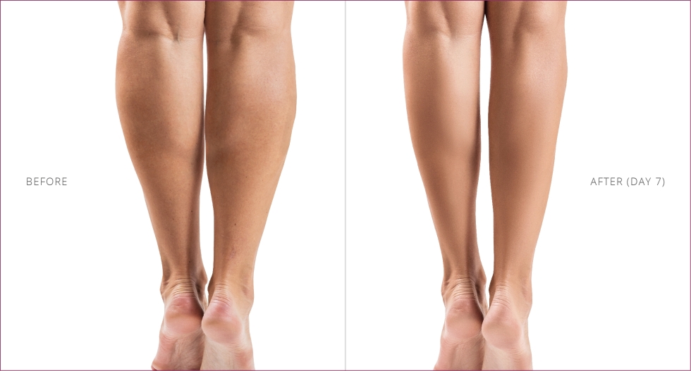 CalfMuscle 02