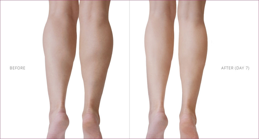 CalfMuscle 05